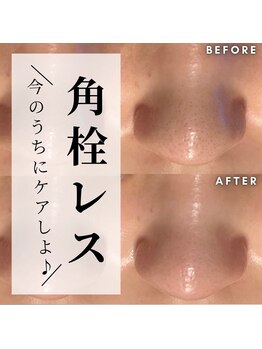 オリオンドットエスツー(Orion.S2)/【Before→After】