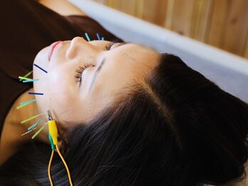 シーワイビー(C.Y.B)の写真/くすみ,たるみ改善ならお任せ♪痛みの少ない電気を流す美容鍼と当院独自の小顔矯正でお悩み改善に導きます!