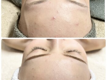 クリアー(CLEAR.)/【Before＆After】