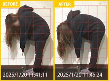 整体院 元 宇城松橋店/首と肩の痛み