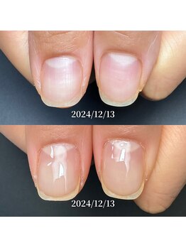 ココ(COCO)/お客様に寄り添う深爪改善