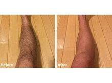 メン脱(Men脱)の雰囲気（これからショートパンツの季節なのでスネ毛の処理も必須ですね！）