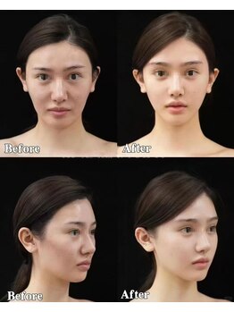 シホン 博多(SHIHON)/