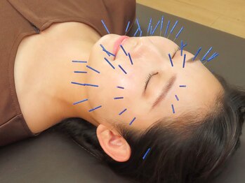 ひまわり鍼灸接骨院/幹細胞美容鍼