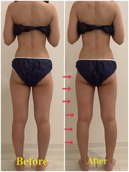 スペチアーレ 夙川/スッキリ脚長