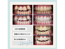 ホワイトニングショップ 水戸駅前店/#水戸ホワイトニング#水戸エステ