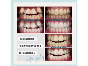 ホワイトニングショップ 水戸駅前店/#水戸ホワイトニング#水戸エステ