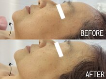 イエローウィーン(YELLOWEEN.)/エイジングケア/小顔引き上げ