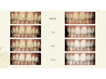 コトリト(Cotorito)の雰囲気（歯科衛生士が歯の色と状態を確認し、あなたに合う方法をご提案）