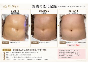 ドクタースタイル(Dr.style)/【施術3回の変化】
