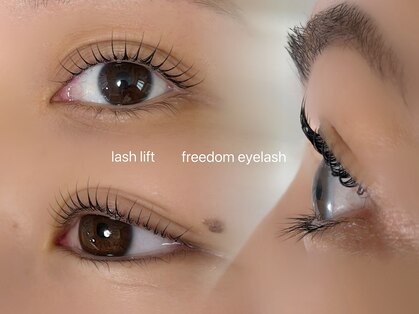 フリーダム(freedom)の写真