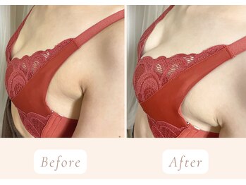 ノルン(Norn)/30代育乳バストケア（1回目）