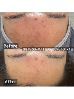 エルエーズ(Elleaise)/お客様に合わせた施術で満足感◎