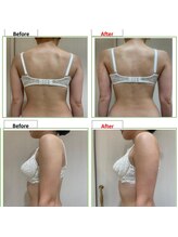 エステティック レイビス 銀座店(RAYVIS)/バストアップ