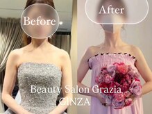 グラツィア 銀座(Grazia)/８回【 ブライダルエステ整体 】