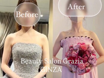 グラツィア 銀座(Grazia)/８回【 ブライダルエステ整体 】