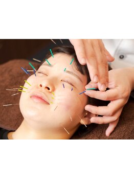 鍼灸施術を受けたい