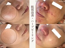 サロンドペシェ(salon de peche)