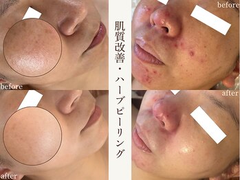 サロンドペシェ(salon de peche)