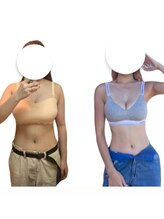 フレックスジム 渋谷店(Flex GYM)/Before/After