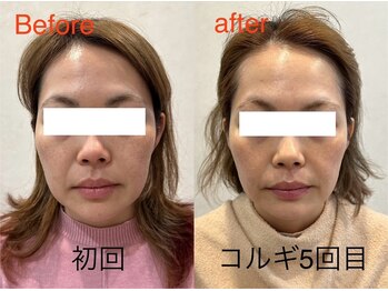 ビーキュート 学芸大学店(BE-CUTE)/Before/After 施術