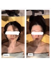 ピュット(pyt)/お顔をシェイプアップさせたい方