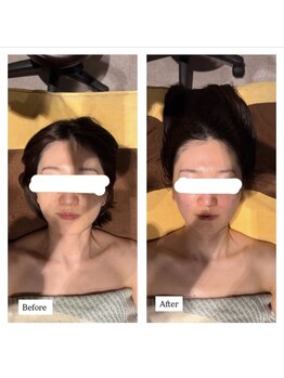 ピュット(pyt)/お顔をシェイプアップさせたい方