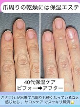 桃の木 吉祥寺店/爪の乾燥も手の乾燥も潤います♪