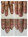 お客様BEFORE/AFTER　2か月