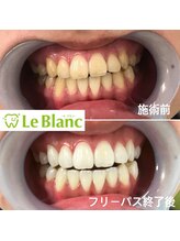 ルブラン 奈良店(Le Blanc)/白くしたい方！！