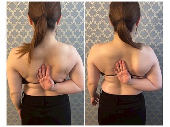 ココア(CoCoa)/肩甲骨洗浄