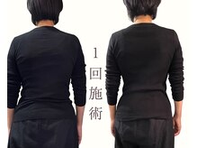 東麻布アマン(東麻布Aman)の雰囲気（当院の美容鍼/もみほぐしマッサージなどは一切なしで華奢も叶う）