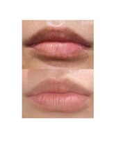 レイサロン(Rey salon)&nbsp;ローマ ピンク