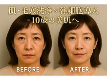 ドクターマジックタッチ(Dr.MAGIC TOUCH)の雰囲気（毛穴専業、角質ピーリング、ヒト幹細胞美肌エイジングケア）