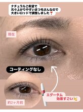 シュピネ(Choupinet)/◯美容液効果比較◯