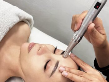 エムジェイ美ボディー(MJ美Body)の写真/【お肌にお悩みの方必見☆】肌に刺激を与えることで新しい肌へ大変身♪肌サイクルでツヤとハリのある肌へ