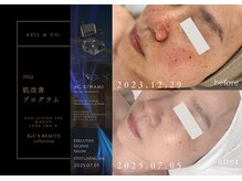オーヴォ リビングスパ アネックス マノン(OVO LIVING SPA annex MANON)/【施術事例】肌改善プログラム