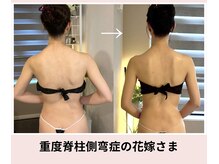 蒼(so)の雰囲気(一般的な整体や機器では解決できない側湾の方へ。『駆け込み寺』)