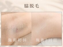 サロン ド ジュエル(salon de jewel)
