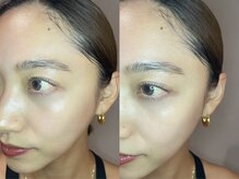 グランウィーユ バイ ロンド 銀座(Grand oeil by Lond)/【mizuki】まつげパーマ