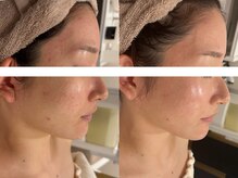 サンオーラ(SUN AURA)/ツヤ爆誕◎肌質改善