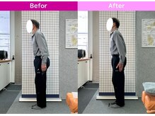 八女整体院/～姿勢改善～腰の痛み