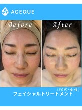 アジーク 町田店(AGEQUE)/50代もしっかりトーンアップ