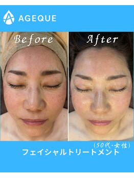 アジーク 町田店(AGEQUE)/50代もしっかりトーンアップ