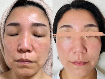 たるみアガル(たるみagaru)/板橋区民の私も変われました