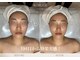 クロシェット(Clochette)の写真