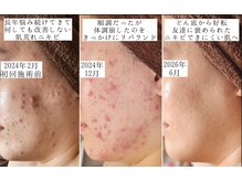 ユウビジン(YOU美人)の雰囲気(諦めなくても大丈夫!肌育成して自分史上最高の素肌へ★)