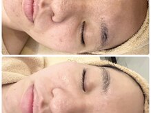 クリアー(CLEAR.)/【Before＆After】