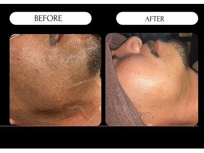 デサフィオ(Desafio.sln)の写真