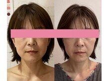 サロンドミジュ(Salon de 美jyu)/骨格・小顔矯正 &nbsp;40代